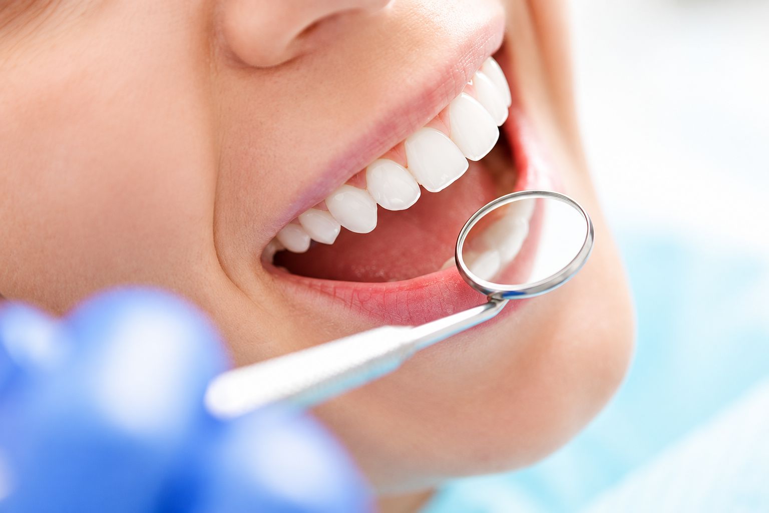 Patient smiling during a dental exam